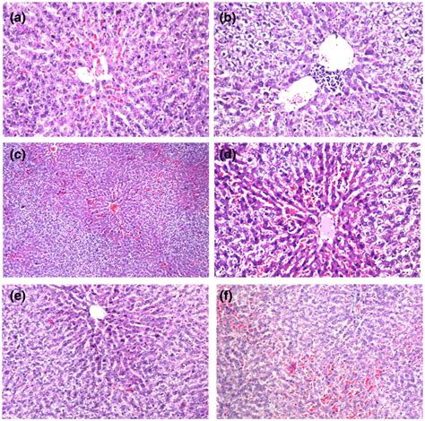 Histopathological Evaluation Of Liver Sections Showing Hepatoprotective Download Scientific