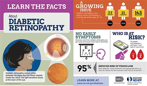 Diabetic Retinopathy Screening Eyenuk Inc ~ Artificial Intelligence Eye Screening