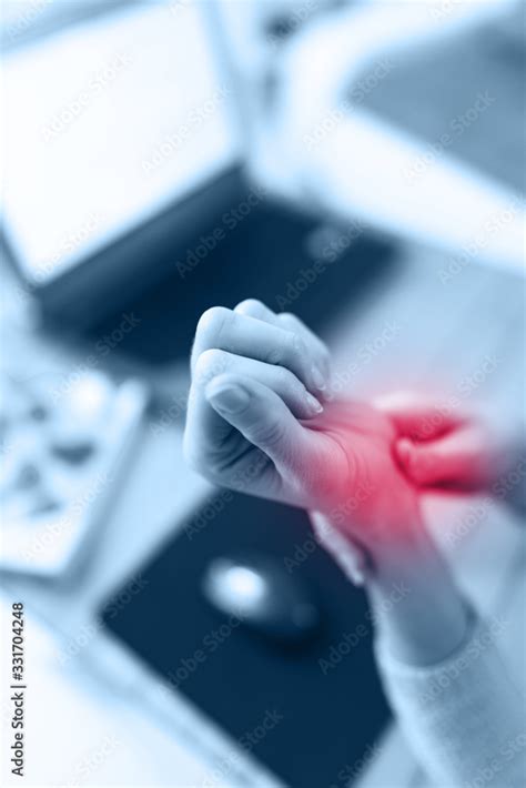 Repetitive Strain Injury RSI From Continuous Working On A Computer