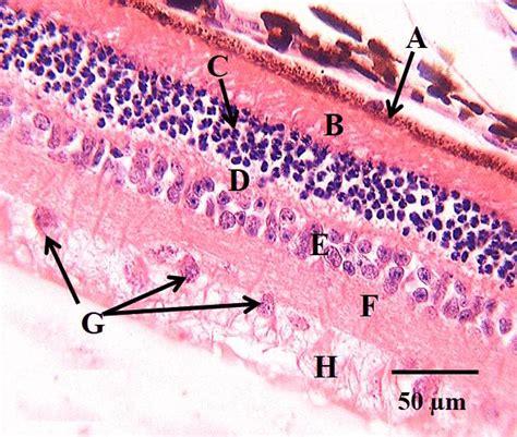 Photomicrograph Of The Retina Of T Swinderianus Retinal Pigment