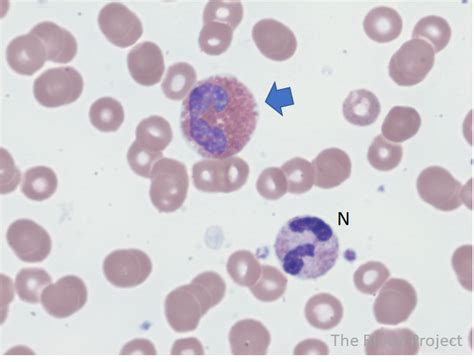 Eosinophils • The Blood Project