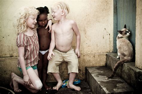 La Onu Alerta Sobre La Extinci N Total De Los Albinos En Malawi