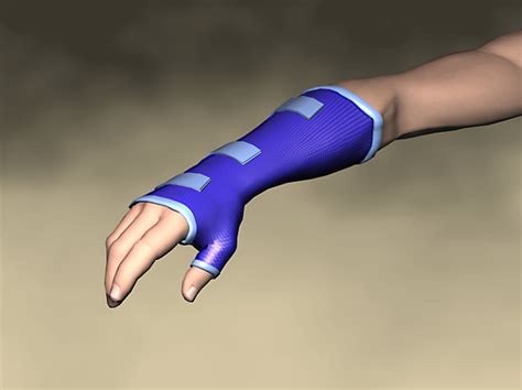 Splinting Hand Upper Limb Centre