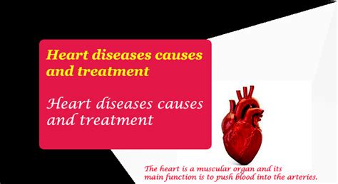 Heart Diseases Causes And Treatment