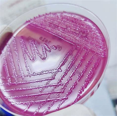 Colonies of Escherichia coli on MacConkey agar palte are pink to dark ...