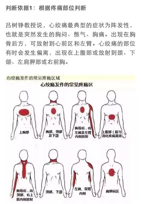 心梗有前兆心脏发出的警报你在意了吗 科普中国网