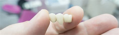 What Is A Porcelain Fixed Bridge At Dentist Of Montclair Ca