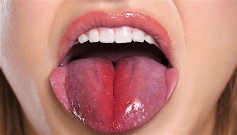 What Does The Color Of Your Tongue Indicate The Road To Optimal