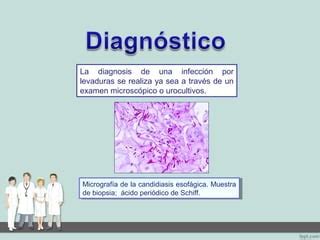 Histolog A De Candida Albicans