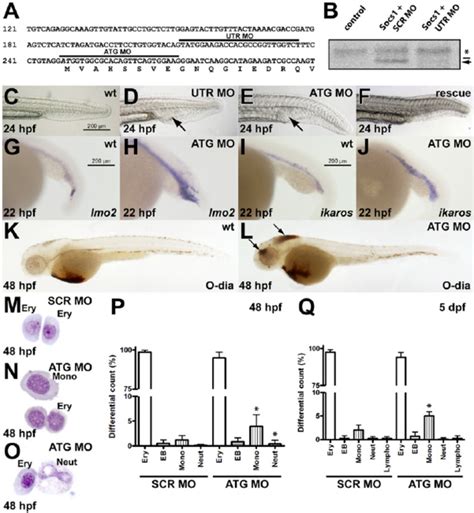 Targeted Knockdown Of Zebrafish Socs1 Perturbs The Site Of Embryonic