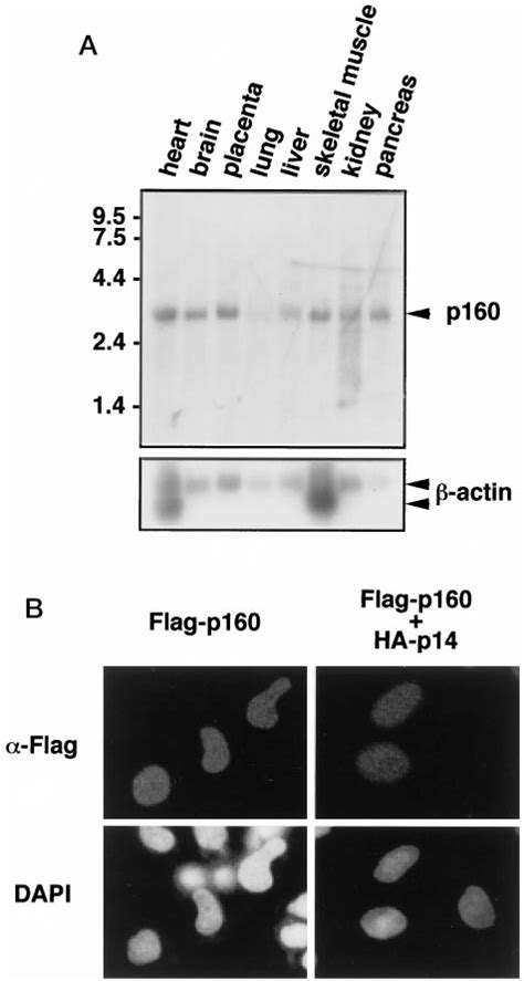 Analysis Of The Expression Pattern Of P160 A Northern Blot Analysis