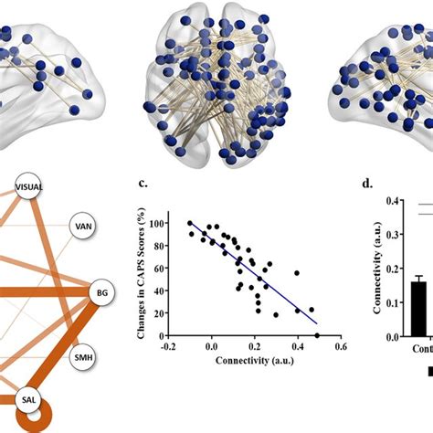 Pre Treatment Functional Connectivity Across The Whole Brain Network In