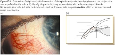 Olver Ophthalmology At A Glance