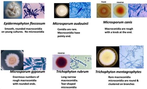 Mycology Final Exam Flashcards Quizlet