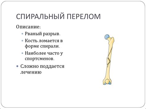 Переломы (6 класс) - online presentation