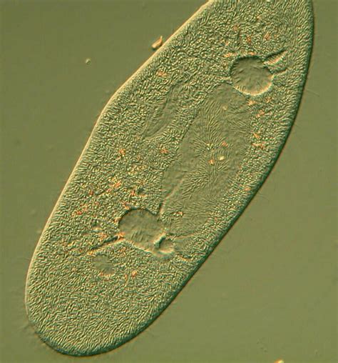 Some Common Protozoa. An Oxymoron.