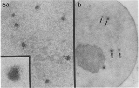 Immunoperoxidase Localization Of Interphase Presumptive Kinetochores