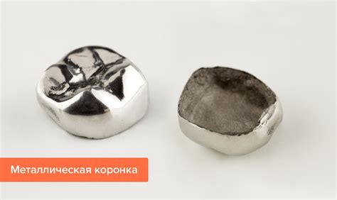 Стальные коронки на зубы преимущества и недостатки