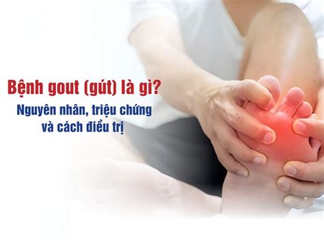 Bệnh Gout Gút Là Gì Nguyên Nhân Triệu Chứng Và Cách điều Trị