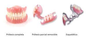 Pr Tesis Removibles Cl Nica Dental Gran V A Zaragoza