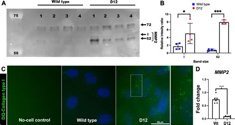 Degradomic Identification Of Membrane Type 1 Matrix Metalloproteinase As An Adamts9 And Adamts20