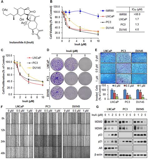 Frontiers Targeting The Nfat1 Mdm2 Mdmx Network Inhibits The