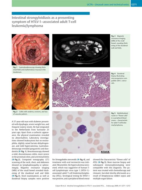 Pdf Intestinal Strongyloidiasis As A Presenting Symptom Of Htlv 1 Associated Adult T Cell