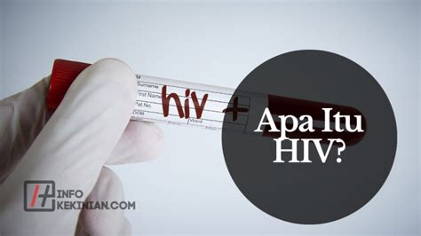 Apa Itu Hiv Penyebab Gejala Dan Cara Pencegahannya Wajib Diketahui