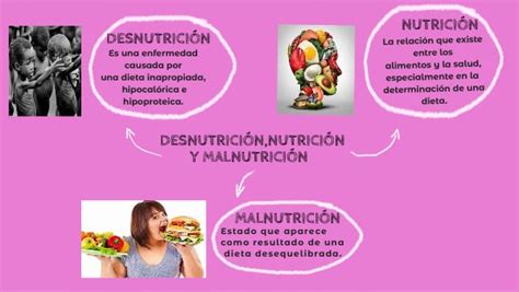 DesnutriciÓn NutriciÓn Y MalnutriciÓn