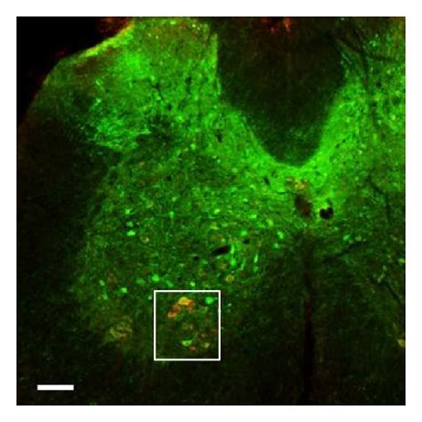 Transduction Of Spinal Cord Motor Neurons Immunohistochemical