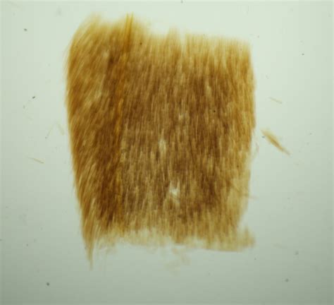 Part Of A Moth Wing Bioquipbugs