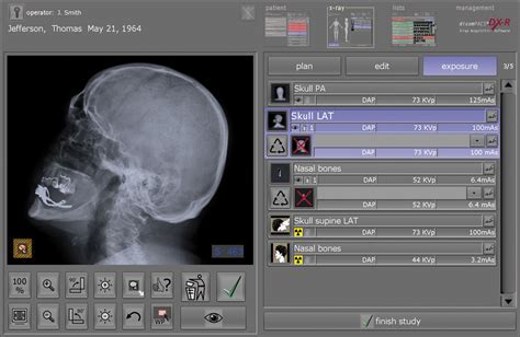 Acquisition and Diagnostic Software