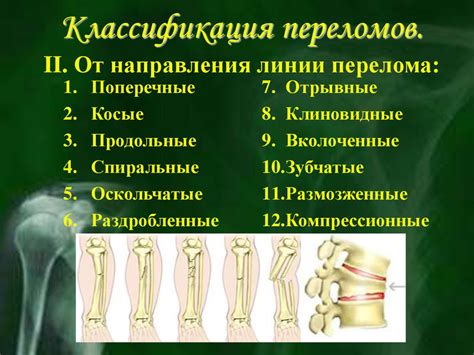 Переломы и вывихи - презентация онлайн