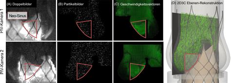 Particle Image Velocimetry zur strömungsmechanischen Analyse des