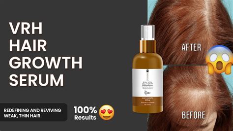 Introducing Vrh Hair Growth Serum Boost Hair Growth And Hair Strength Stops Hairfall Vrh