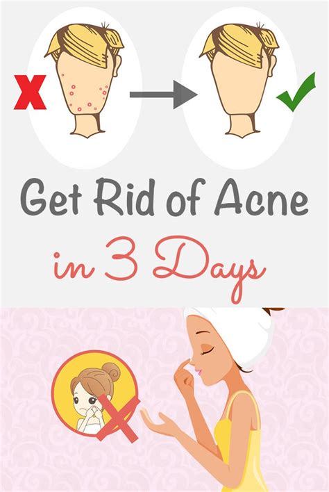 Get Rid Of Acne In 3 Days Iwomenhacks