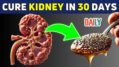 Top Superfoods To Heal Kidneys And Stop Proteinuria Instantly In 30