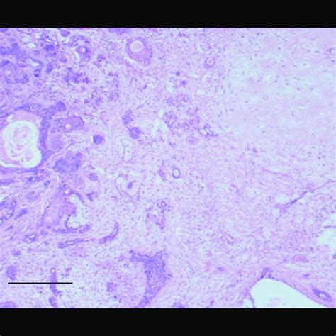 Histopathology Of Pleomorphic Adenoma Sections Show A Cellular Lesion Download Scientific