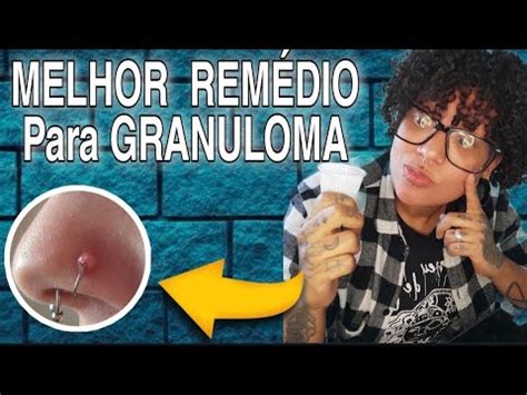 Como Tirar Granuloma De Qualquer Piercing Youtube