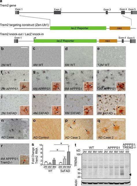 Trem2 Expression Is Increased Around Aβ Plaques A A Novel Trem2