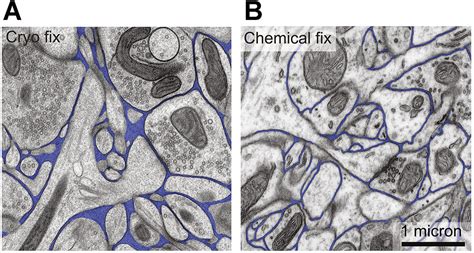 Exploring The Interstitial System In The Brain The Last Mile Of Drug