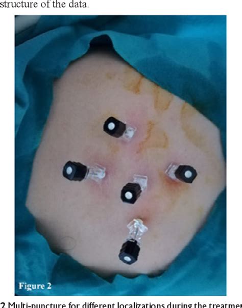 Figure 1 From Percutaneous Treatment With The Ormeci Technique Of Cystic Echinococcosis