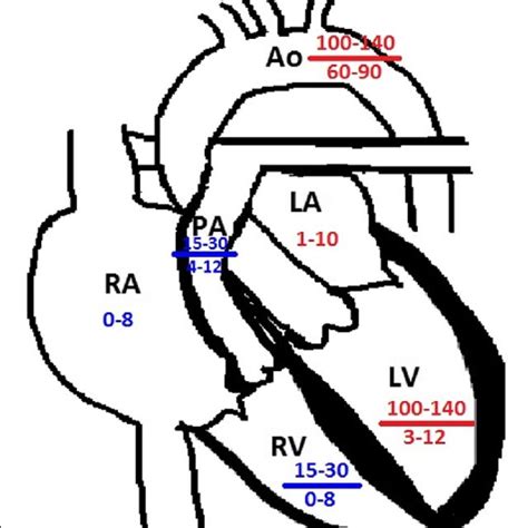 Measurement Of Rvlv Ratio Axial Ct Images Demonstrate The Best Download Scientific Diagram