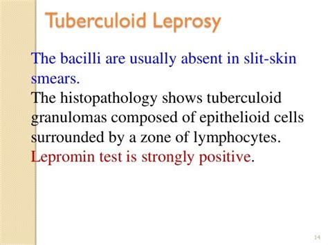 Pathophysiology of Leprosy