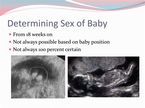 Ppt Prenatal Care And Ultrasounds Powerpoint Presentation Free Download Id4509383