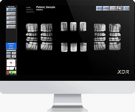 Product Software XDR Radiology