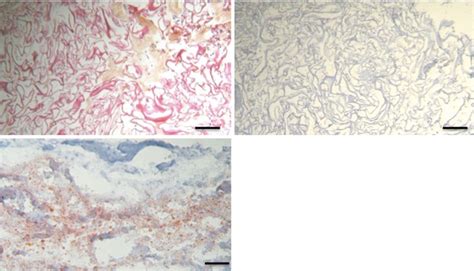 Stem Cells Mature Adipocytes And Extracellular Matrix What Does Each