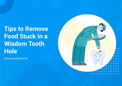 How To Safely Remove Food Stuck In A Wisdom Tooth Hole Tips And Tricks