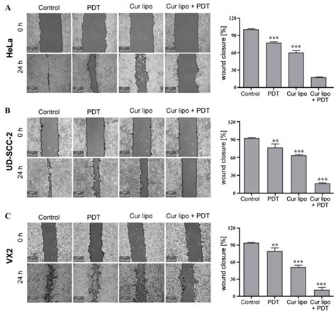 Cell Migration Wound Healing Assay In Hela Ud Scc 2 And Vx2 Cells