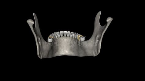 The Mandibular Second Molar Resembles The Mandibular First Permanent